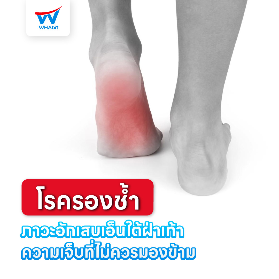 1-1_โรครองช้ำ